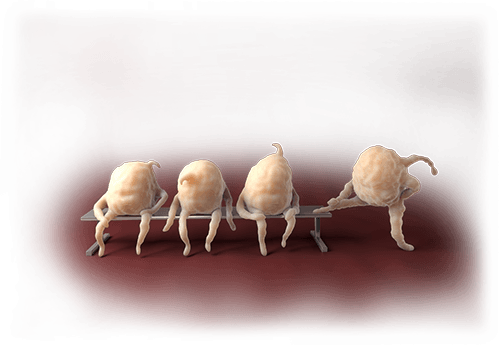 KENGREAL® is the first and only intravenous P2Y12 receptor inhibitor