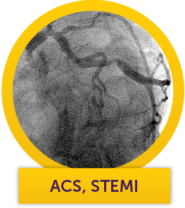 Kenneth's angiogram