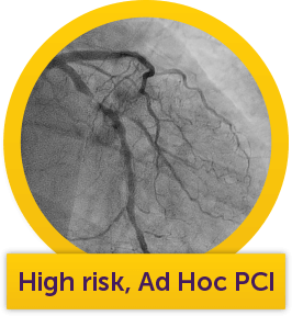 Rafael's angiogram