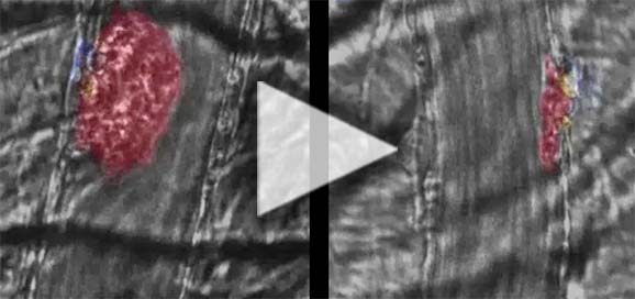Watch a video about KENGREAL clot inhibition in vivo