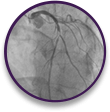 Angiogram of emergent case–absorption issues