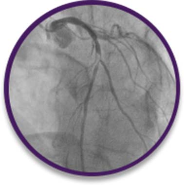 Emergent case–absorption issues
