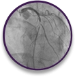 cp-accordion-image-1_emerg Vessel structure in emergent case profile